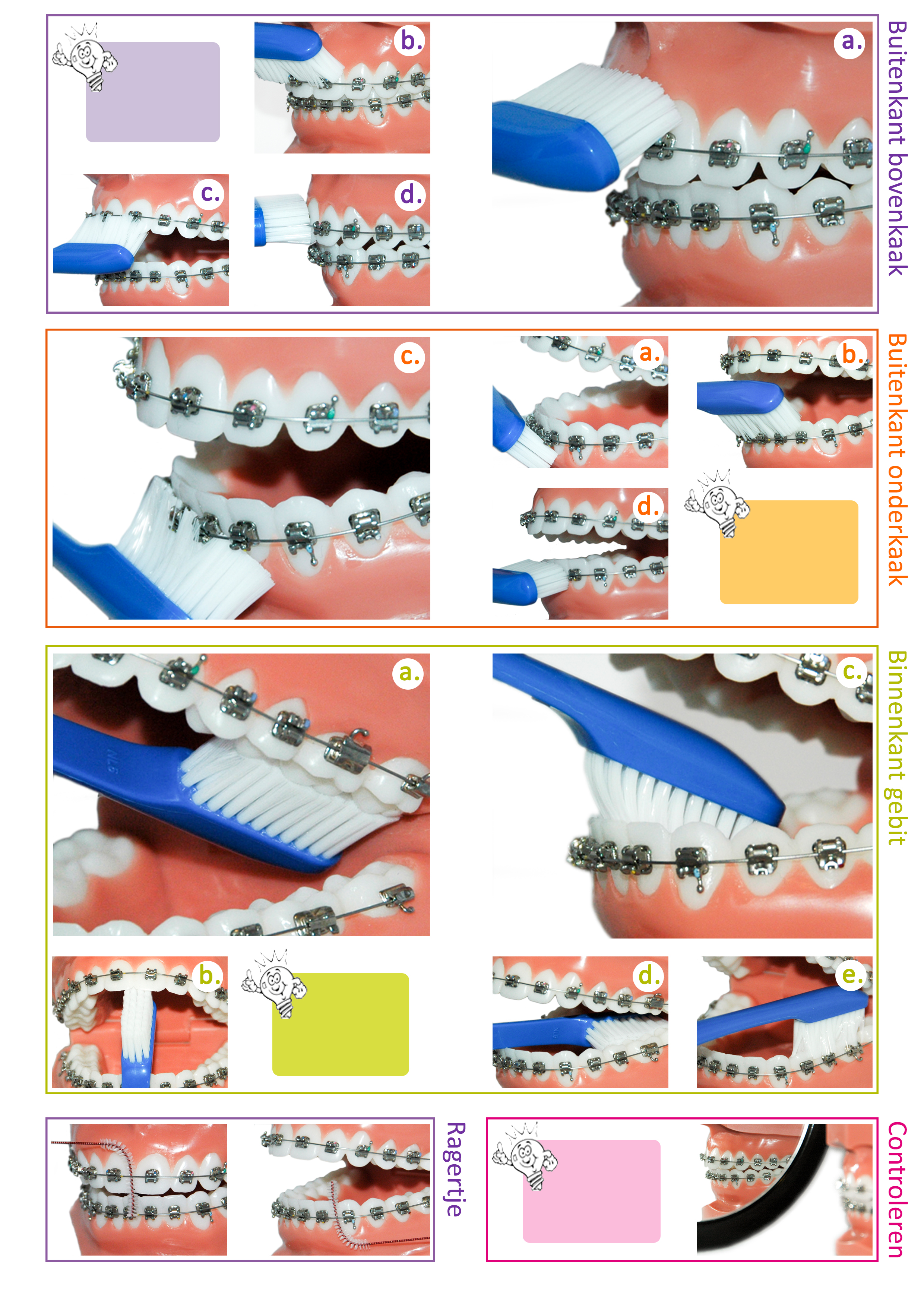 Instructies Orthodontie Osdorp